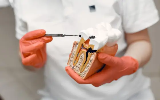 Dental tooth model showing root canal treatment