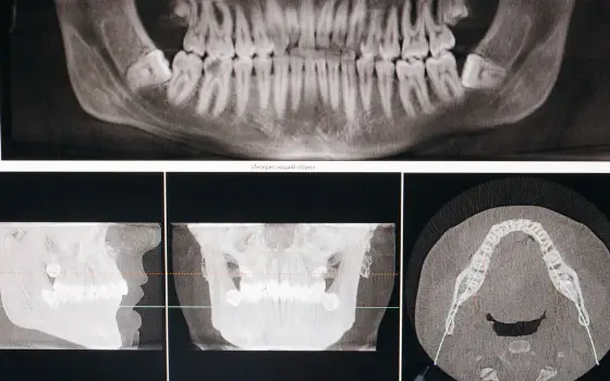 Panoramic dental X-ray and scans